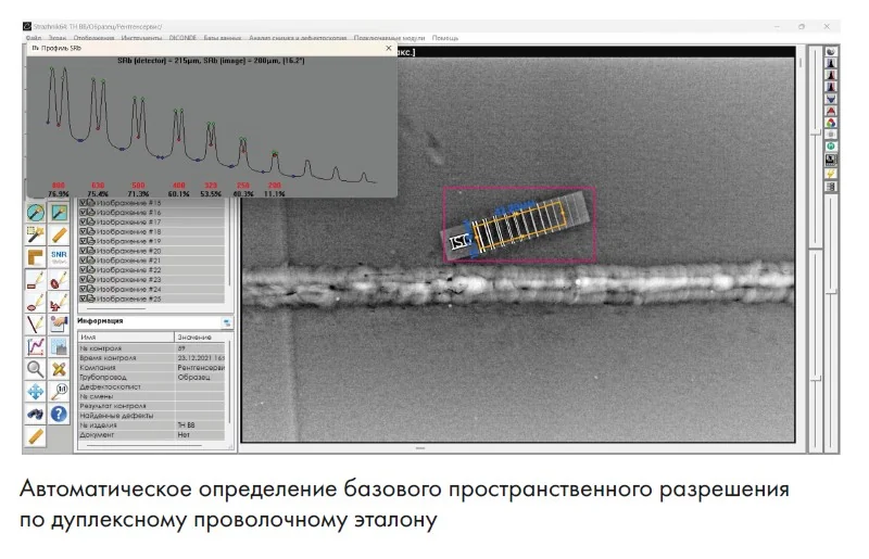 Комплекс цифровой радиографии типа Экоскан -10