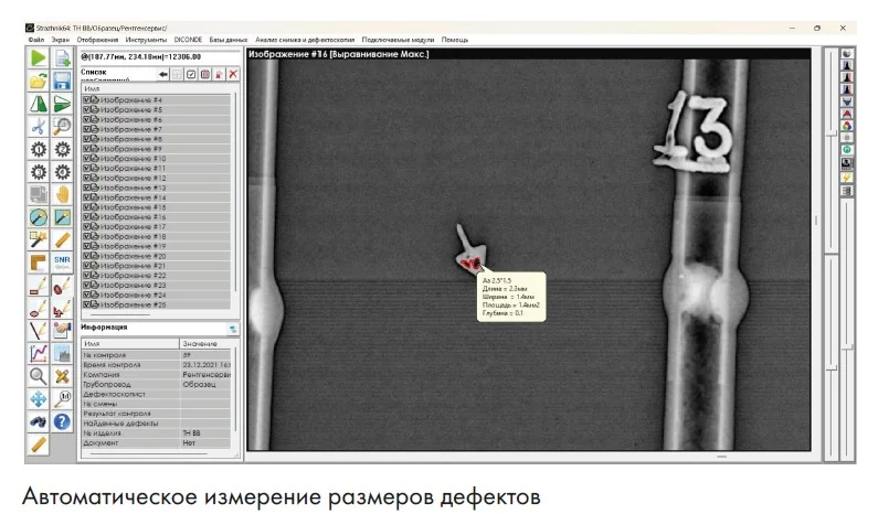 Комплекс цифровой радиографии типа Экоскан -10