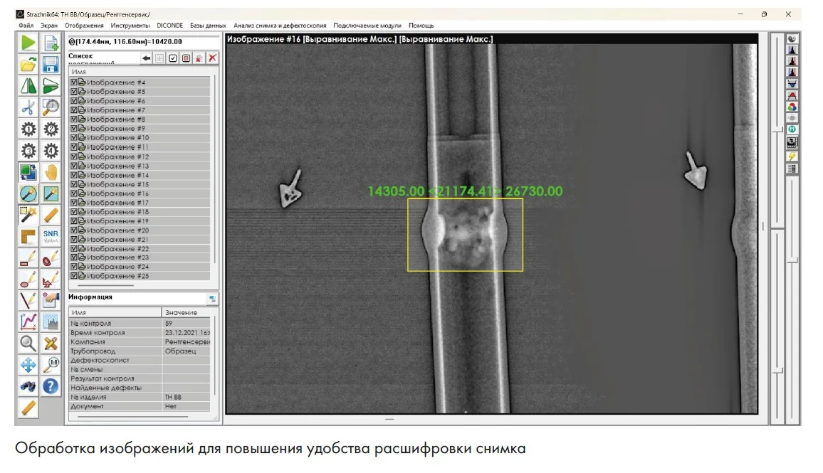 Комплекс цифровой радиографии типа Экоскан -10